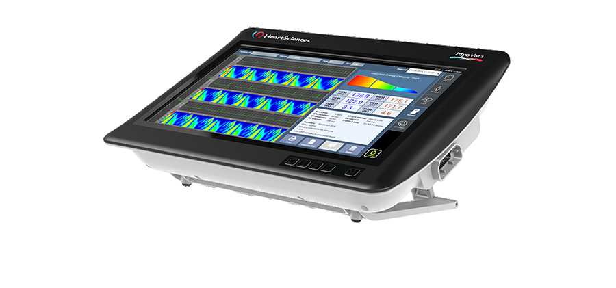Myovista wavECG
